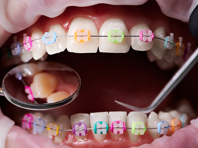 New Image Orthodontics | Dentures, TMJ Disorders and Teeth Whitening